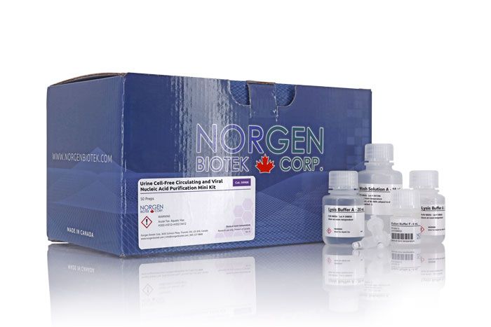 Urine Cell-Free Circulating and Viral Nucleic Acid Purification Mini Kit